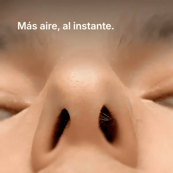 Nuvalyo AirFlow Pro™ | Dilatador Nasal Magnético
